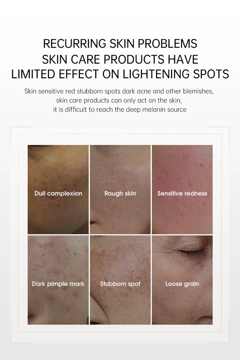 Home Use Red Light Therapy LED 4 Colors Facial Mask Skin Moisturize Rejuvenation Wrinkle Removal Anti Acne Shrink Pores Salon